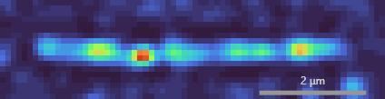 CondensinSupercoil.gif